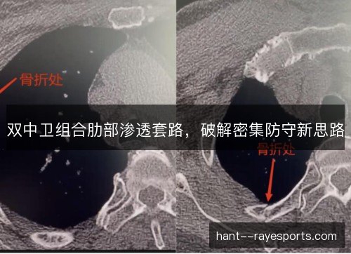 双中卫组合肋部渗透套路，破解密集防守新思路